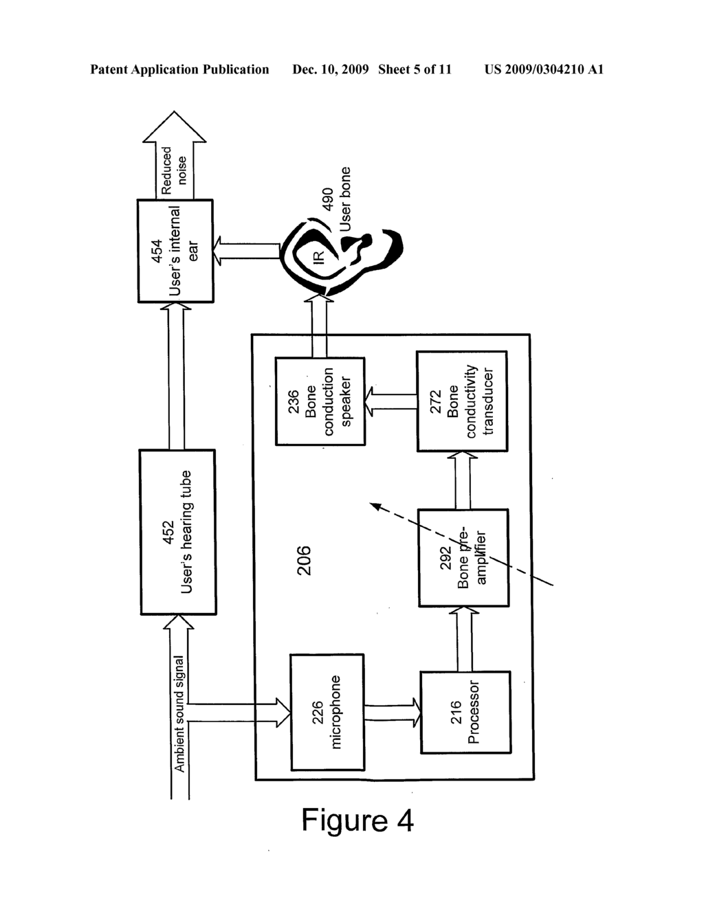 Method and System for Bone Conduction Sound Propagation - diagram, schematic, and image 06