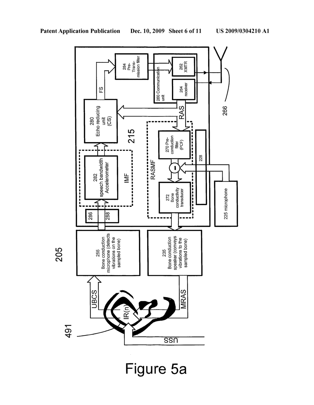 Method and System for Bone Conduction Sound Propagation - diagram, schematic, and image 07