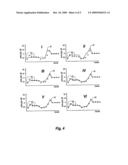 HEARING AID AND A METHOD FOR ENHANCING SPEECH INTELLIGIBILITY diagram and image