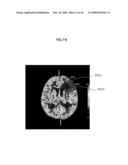 IMAGE ANALYZING SYSTEM AND METHOD diagram and image