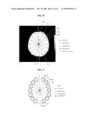 IMAGE ANALYZING SYSTEM AND METHOD diagram and image