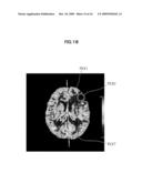 IMAGE ANALYZING SYSTEM AND METHOD diagram and image