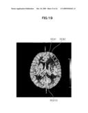 IMAGE ANALYZING SYSTEM AND METHOD diagram and image