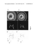 Method and a system for presenting sections of a histological specimen diagram and image