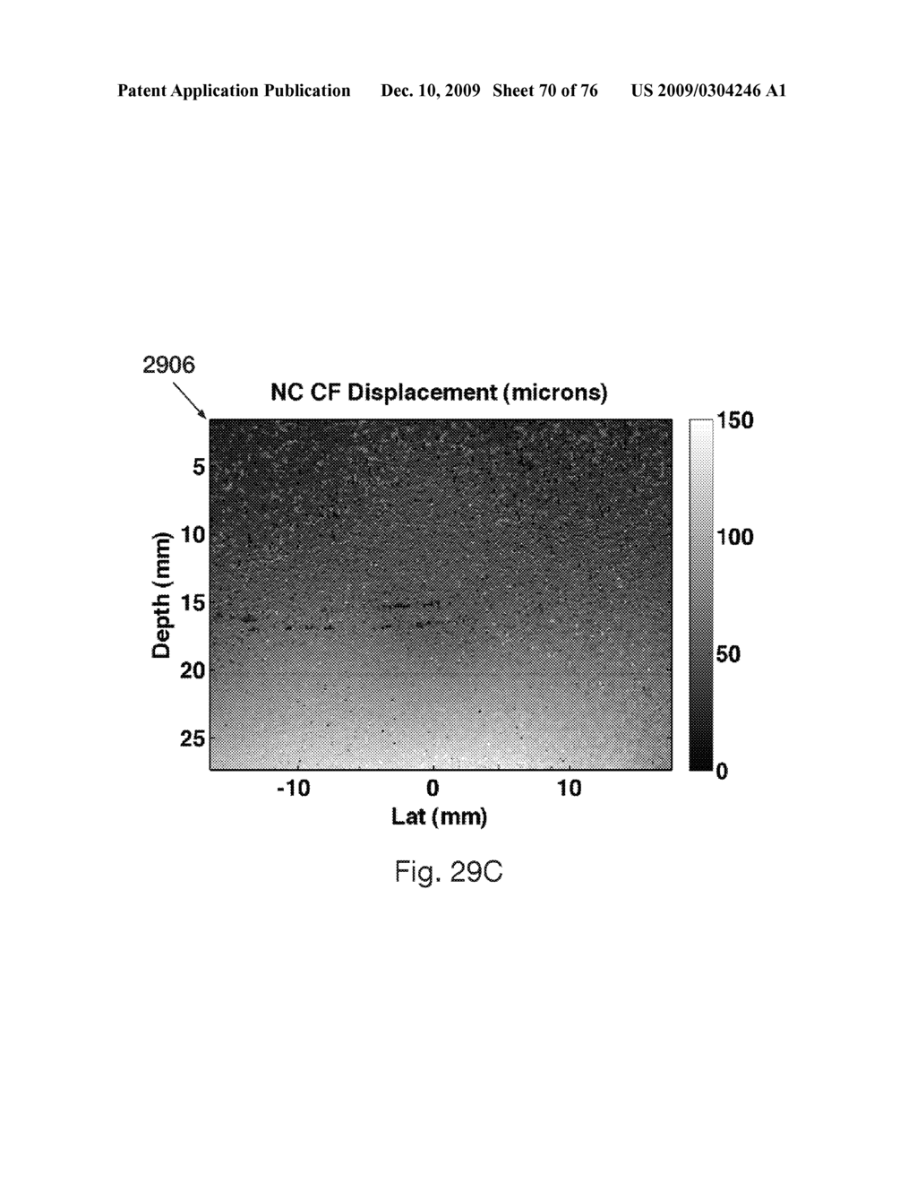 REDUCTION OF ECHO DECORRELATION FACILITATING MOTION ESTIMATION - diagram, schematic, and image 71