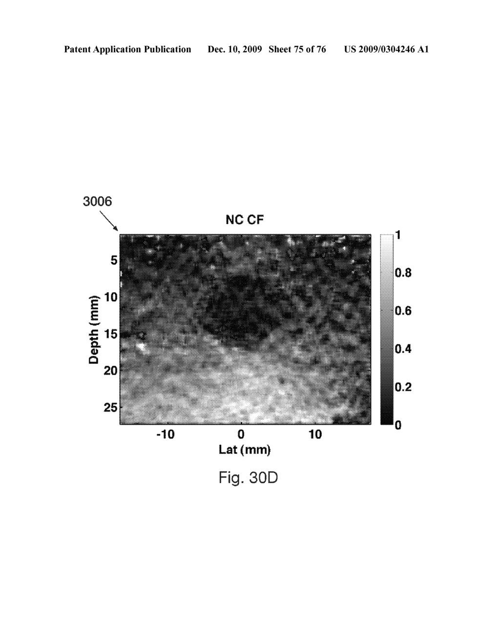 REDUCTION OF ECHO DECORRELATION FACILITATING MOTION ESTIMATION - diagram, schematic, and image 76