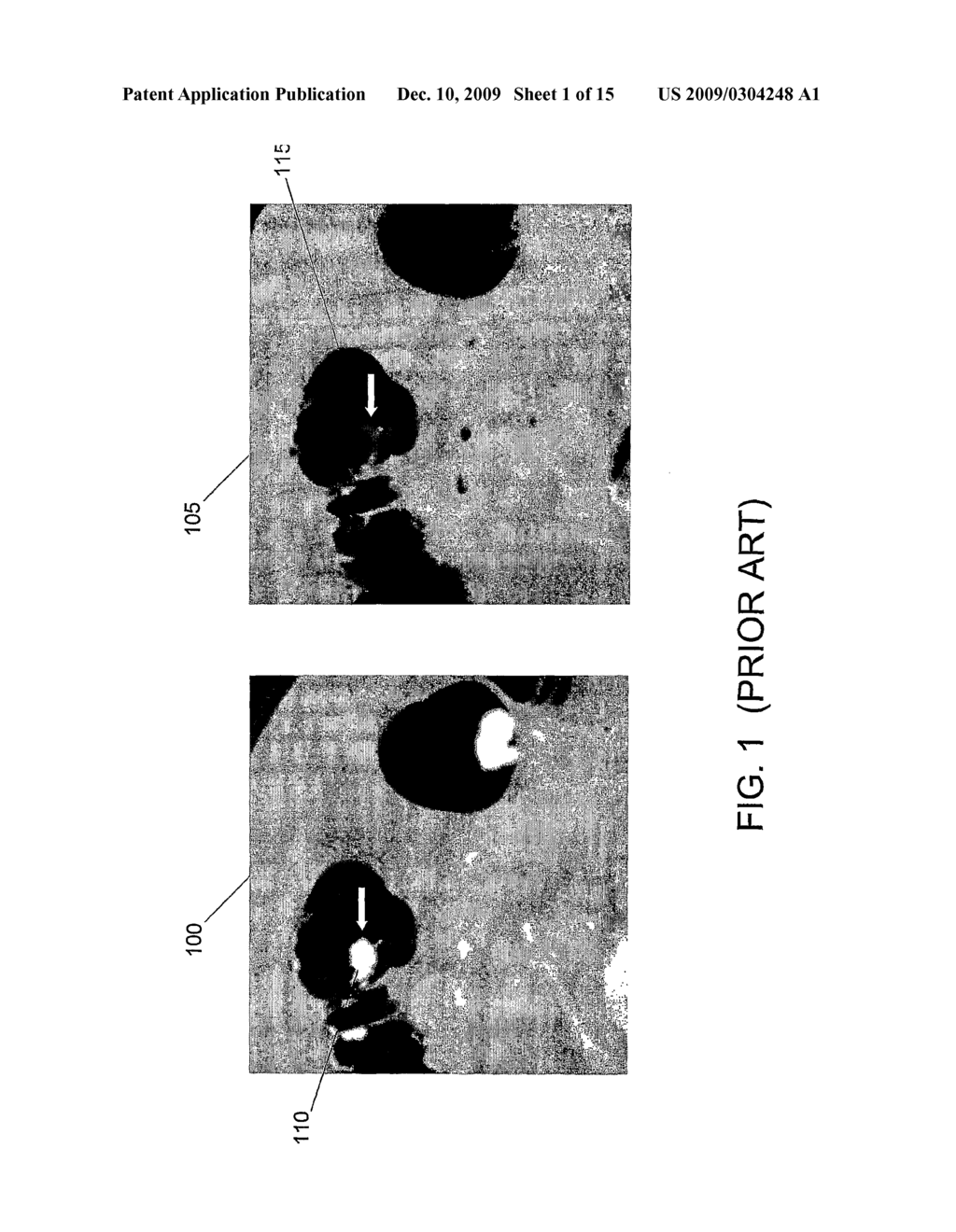 Structure-analysis system, method, software arrangement and computer-accessible medium for digital cleansing of computed tomography colonography images - diagram, schematic, and image 02