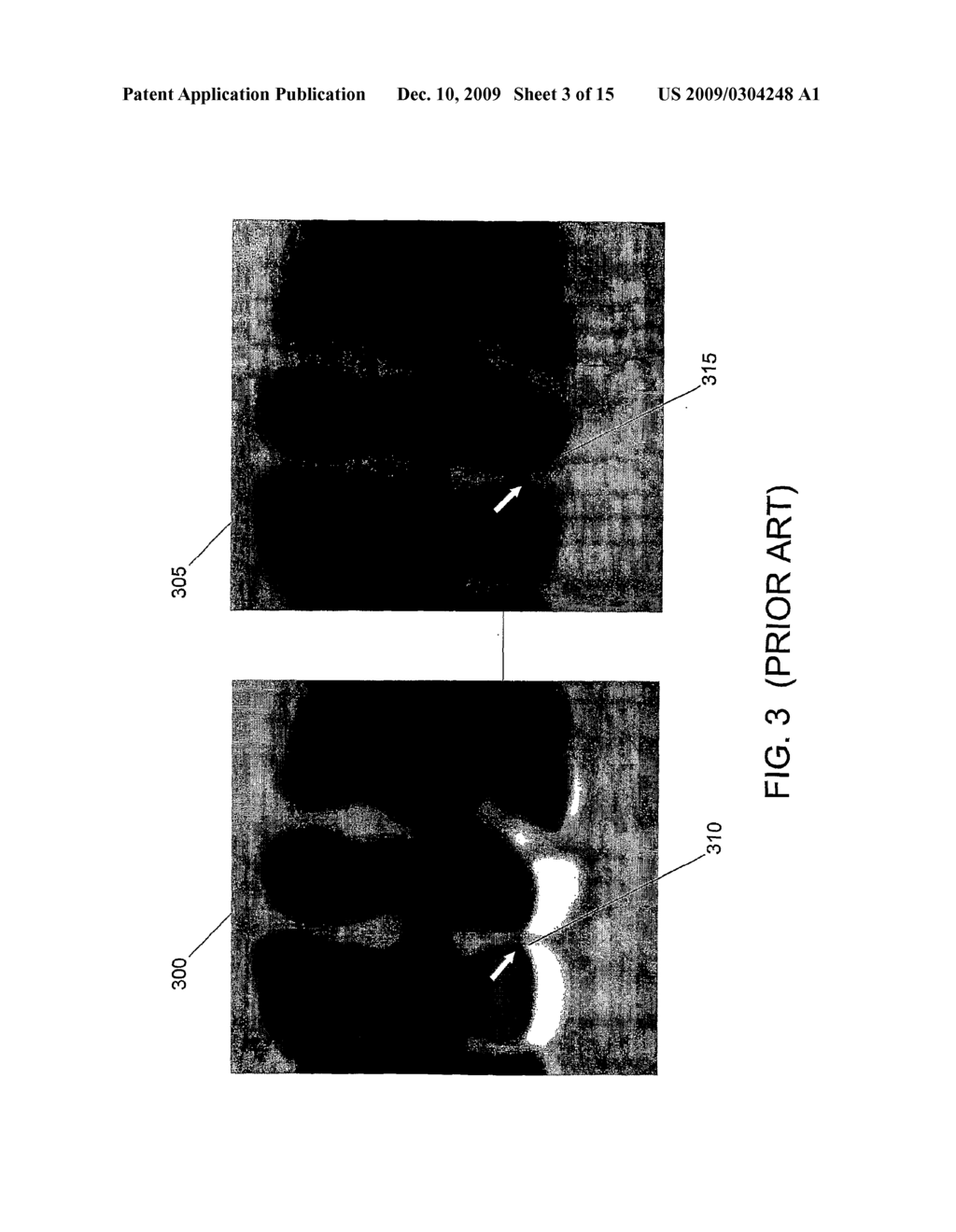 Structure-analysis system, method, software arrangement and computer-accessible medium for digital cleansing of computed tomography colonography images - diagram, schematic, and image 04