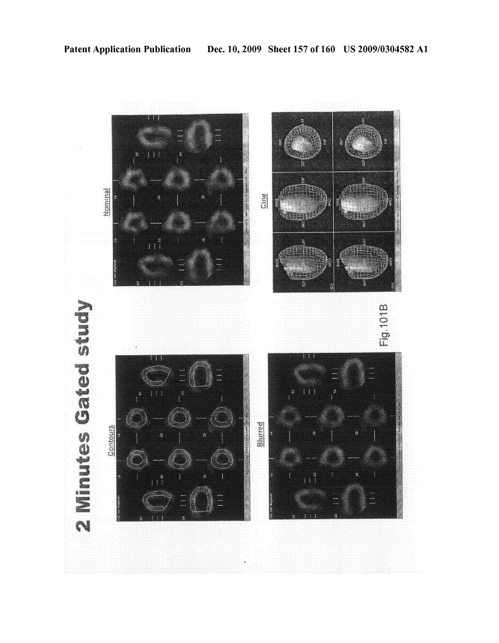 Imaging Protocols - diagram, schematic, and image 158