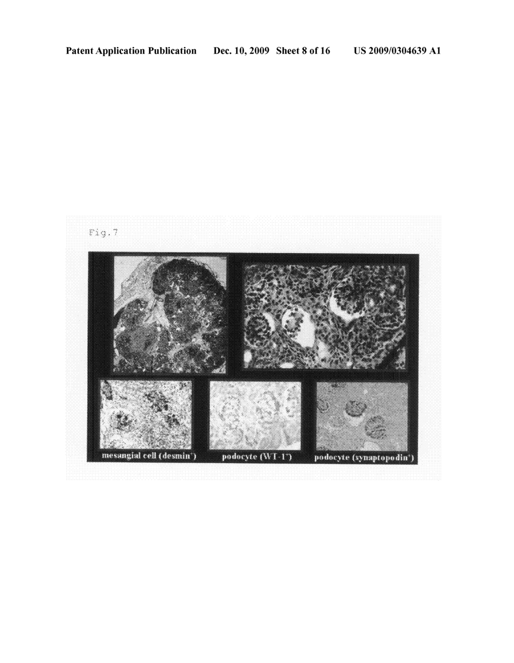 Method for preparing an organ for transplantation - diagram, schematic, and image 09