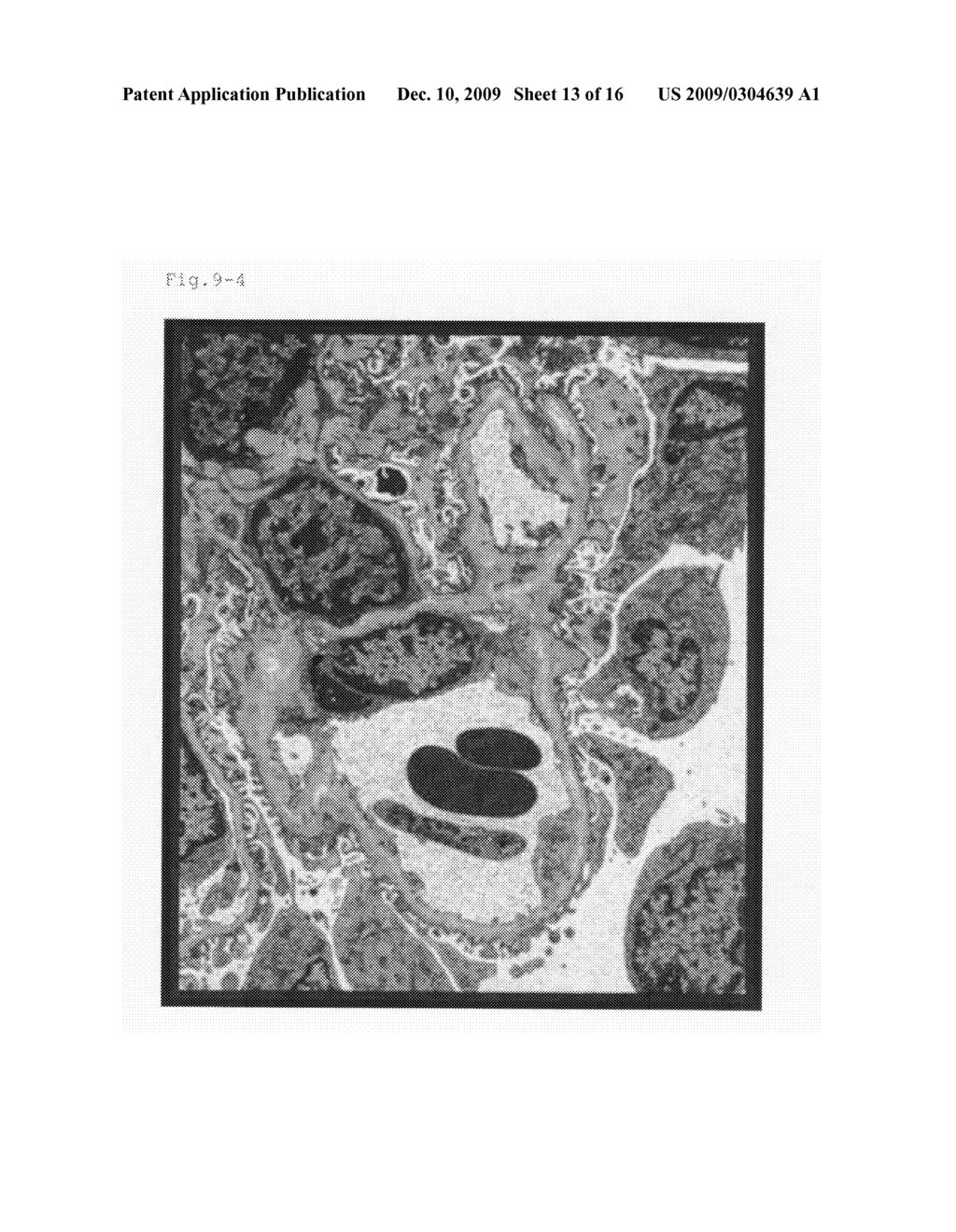 Method for preparing an organ for transplantation - diagram, schematic, and image 14