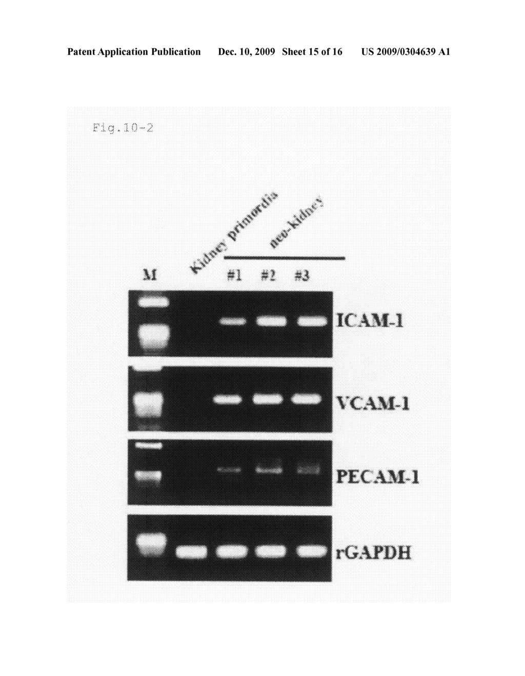 Method for preparing an organ for transplantation - diagram, schematic, and image 16