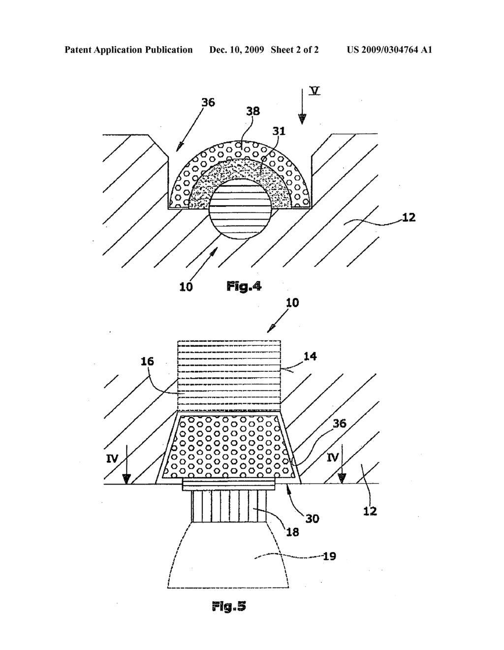 Bone Regeneration Element for Stabilising Artificial Tooth Roots - diagram, schematic, and image 03