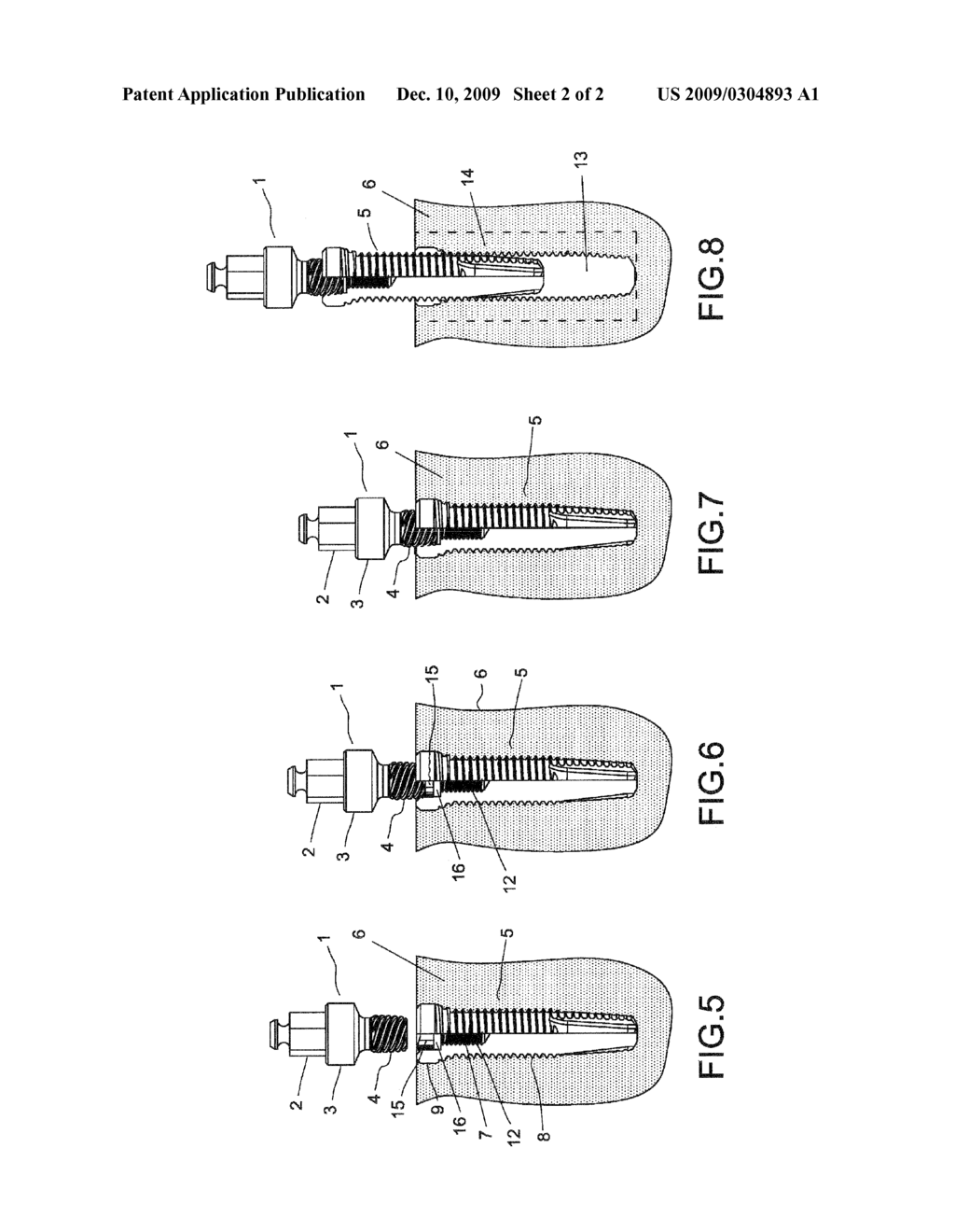 AERATED FOOD PRODUCT AND METHOD OF MANUFACTURING SUCH PRODUCT - diagram, schematic, and image 03