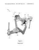 Method Of Designing Custom Articulator Inserts Using Four-Dimensional Data diagram and image