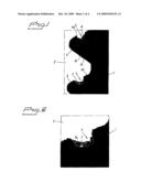 IMPLANT ARRANGEMENT diagram and image