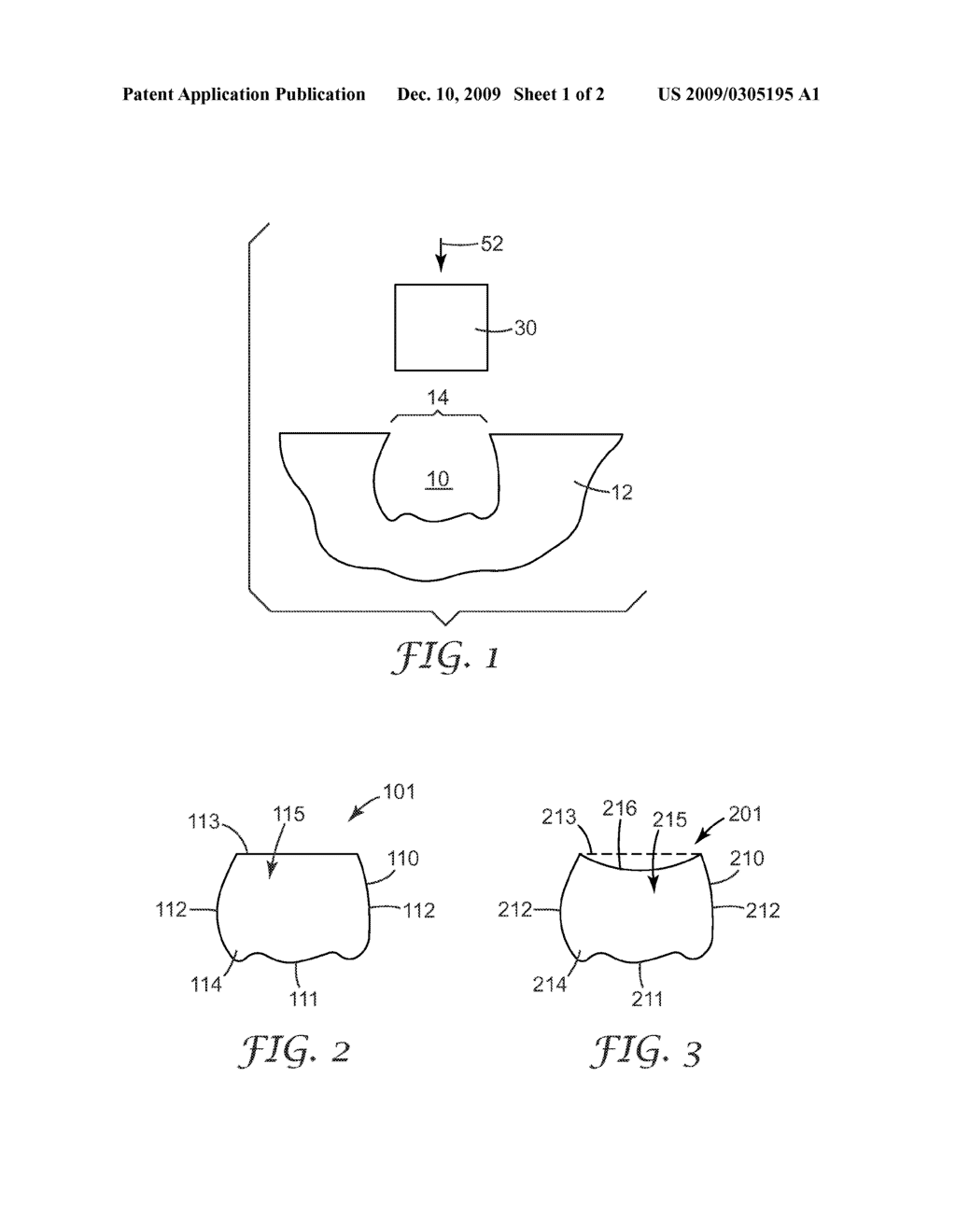 PREFORMED MALLEABLE SOLID CROWN - diagram, schematic, and image 02