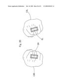 TRAINING METHOD, TRAINING DEVICE, AND COORDINATION TRAINING METHOD diagram and image