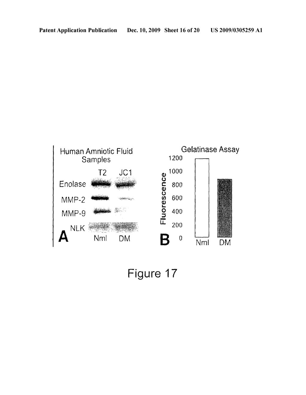 Early Diagnosis of Congenital Abnormalities in the Offspring of Diabetic Mothers - diagram, schematic, and image 17