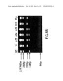 Gene Differentially Expressed in Breast and Bladder Cancer and Encoded Polypeptides diagram and image