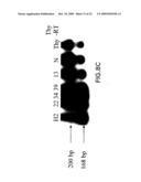 Gene Differentially Expressed in Breast and Bladder Cancer and Encoded Polypeptides diagram and image