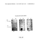 Gene Differentially Expressed in Breast and Bladder Cancer and Encoded Polypeptides diagram and image