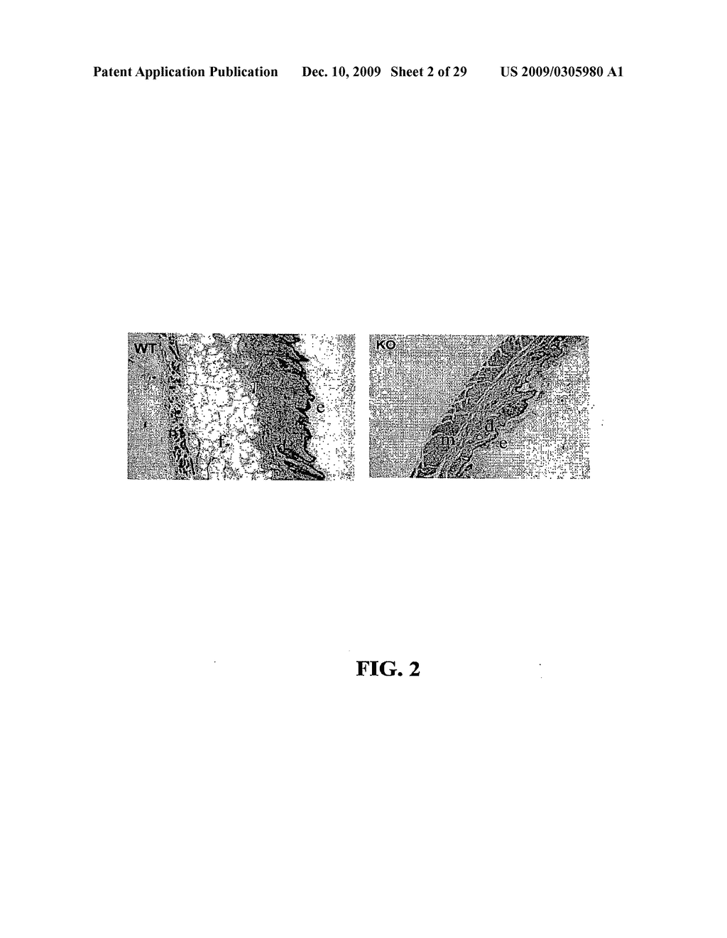 Methods and Compositions Related to TR4 - diagram, schematic, and image 03