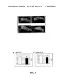 Methods and Compositions Related to TR4 diagram and image