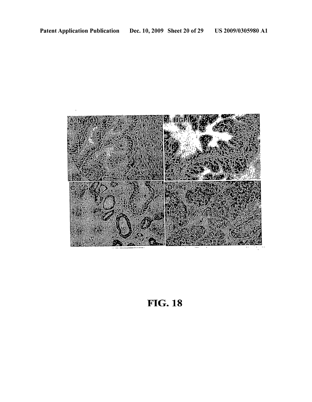 Methods and Compositions Related to TR4 - diagram, schematic, and image 21