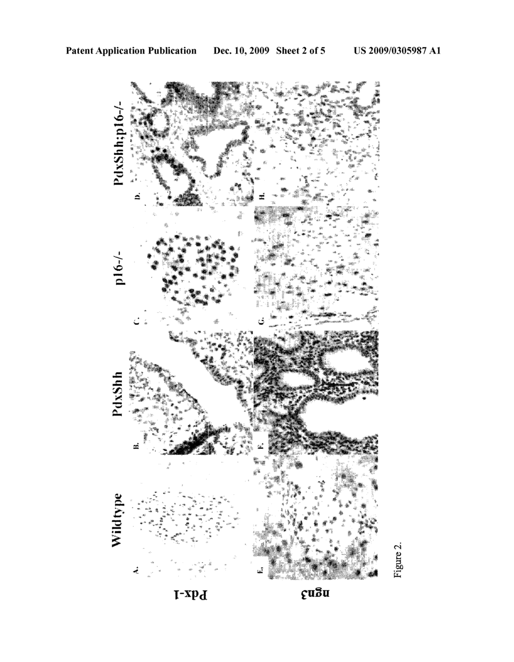 Method For Inducing Beta Cell Neogenesis From Epithelial Cells - diagram, schematic, and image 03