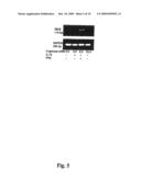 USE OF AN INTERLEUKIN 1 RECEPTOR ANTAGONIST AND/OR PYRROLIDINEDITHIOCARBAMATE FOR THE TREATMENT OR PROPHYLAXIS OF TYPE 2 DIABETES diagram and image