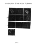 USE OF AN INTERLEUKIN 1 RECEPTOR ANTAGONIST AND/OR PYRROLIDINEDITHIOCARBAMATE FOR THE TREATMENT OR PROPHYLAXIS OF TYPE 2 DIABETES diagram and image