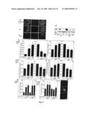 USE OF AN INTERLEUKIN 1 RECEPTOR ANTAGONIST AND/OR PYRROLIDINEDITHIOCARBAMATE FOR THE TREATMENT OR PROPHYLAXIS OF TYPE 2 DIABETES diagram and image