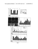 USE OF AN INTERLEUKIN 1 RECEPTOR ANTAGONIST AND/OR PYRROLIDINEDITHIOCARBAMATE FOR THE TREATMENT OR PROPHYLAXIS OF TYPE 2 DIABETES diagram and image