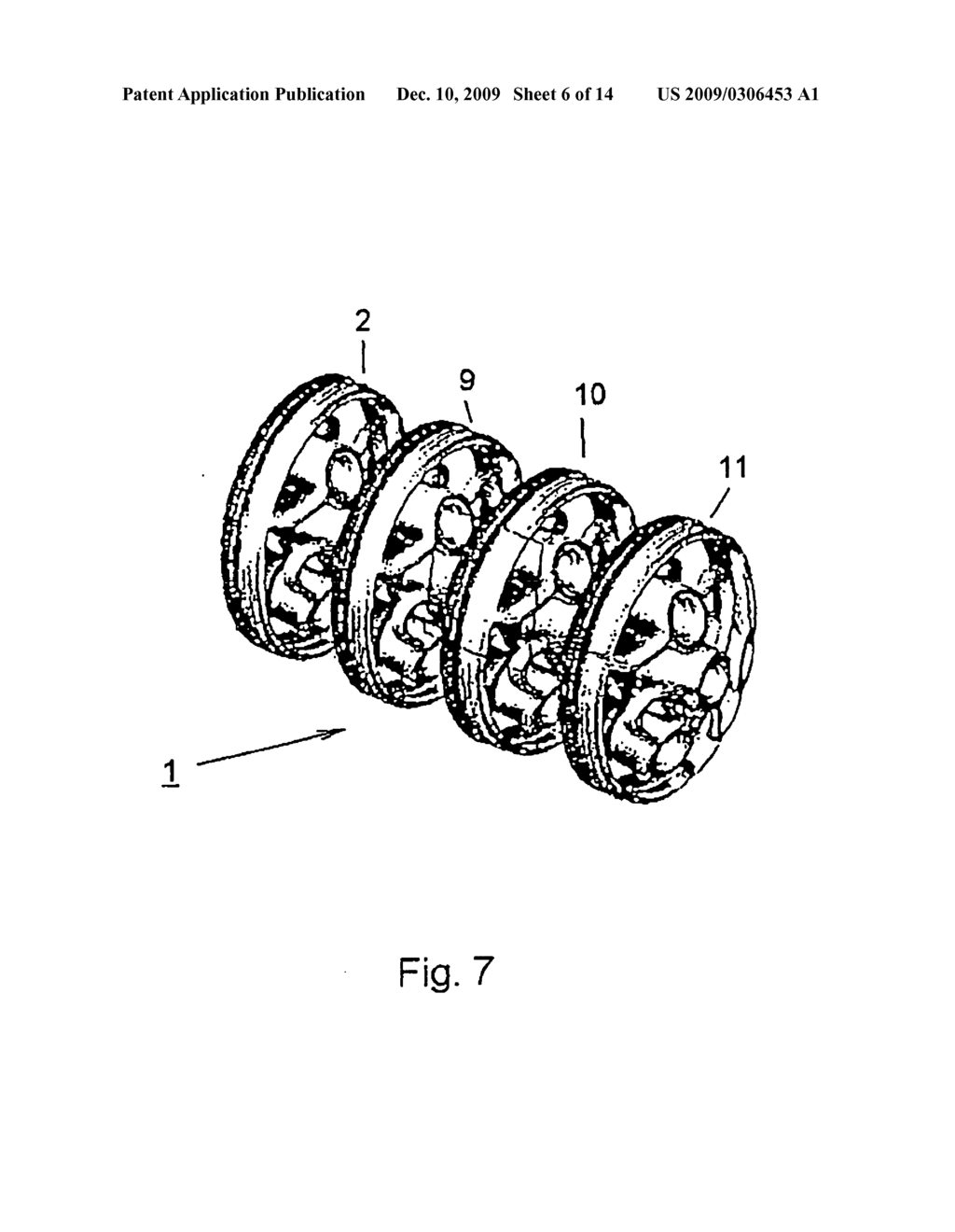 Implant for Treating the Internal Walls of a Resection Cavity - diagram, schematic, and image 07