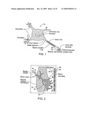 Devices and Methods for Stimulation of Tissue diagram and image