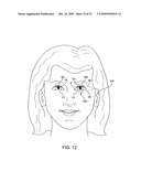 Devices and Methods for Stimulation of Tissue diagram and image