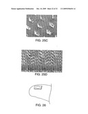 Devices and Methods for Stimulation of Tissue diagram and image