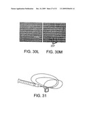 Devices and Methods for Stimulation of Tissue diagram and image