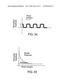 Devices and Methods for Stimulation of Tissue diagram and image