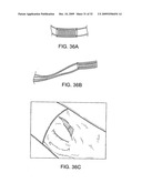 Devices and Methods for Stimulation of Tissue diagram and image