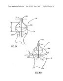 Gastric band diagram and image