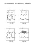 IN VIVO CAMERA WITH MULTIPLE SOURCES TO ILLUMINATE TISSUE AT DIFFERENT DISTANCES diagram and image