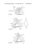 ULTRASONIC DIAGNOSTIC APPARATUS diagram and image