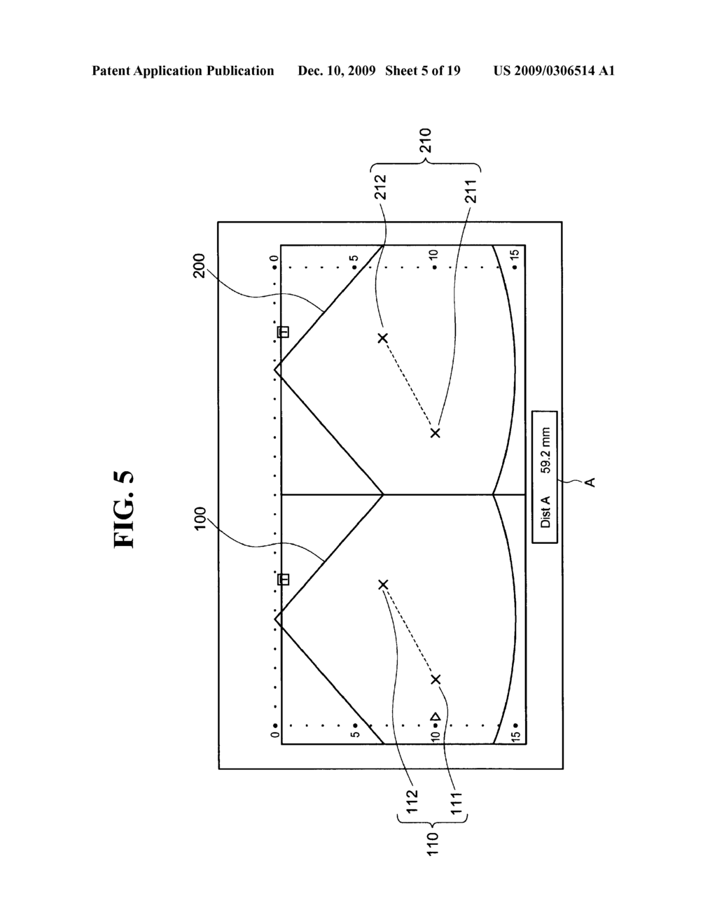 ULTRASOUND IMAGING APPARATUS AND METHOD FOR DISPLAYING ULTRASOUND IMAGE - diagram, schematic, and image 06