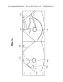 ULTRASOUND IMAGING APPARATUS AND METHOD FOR DISPLAYING ULTRASOUND IMAGE diagram and image