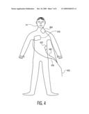 Apparatus and Method for Defibrillation Pulse Detection Using Electromagnetic Waves diagram and image