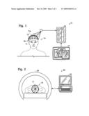 Method for locating tracts of electrical brain activity diagram and image