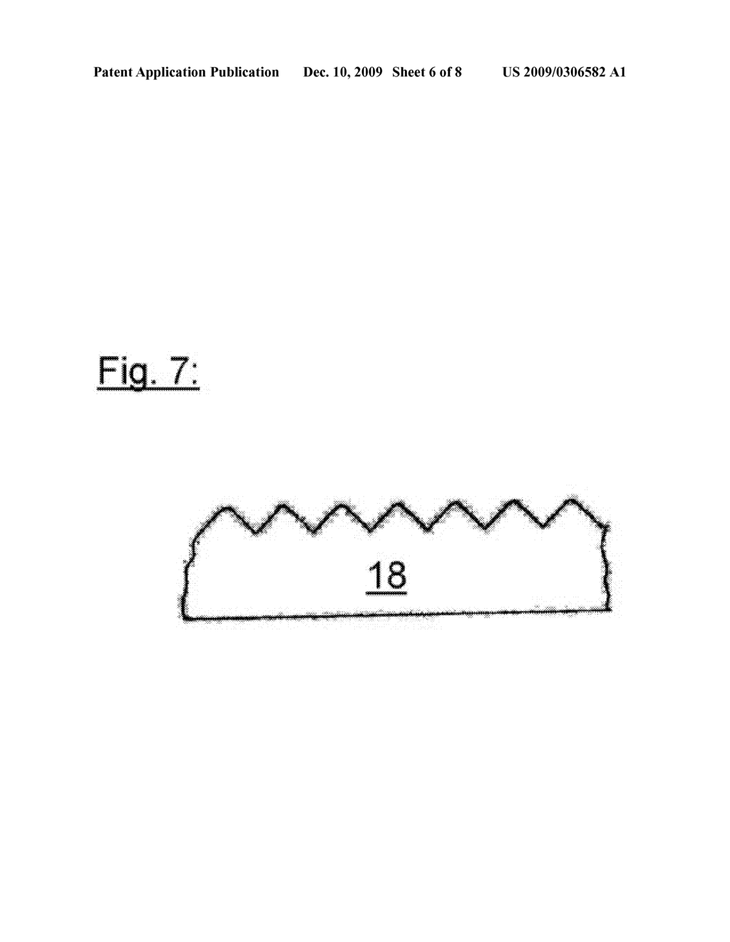 SCORING CATHETER AND METHOD FOR TREATING DISEASED HEART VALVES - diagram, schematic, and image 07