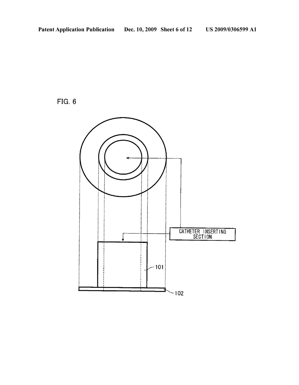 FLOCKED MEDICAL INSTRUMENT TO BE PLACED IN THE BODY, METHOD OF PRODUCING THE MEDICAL INSTRUMENT TO BE PLACED IN THE BODY AND APPARATUS FOR PRODUCING THE MEDICAL INSTRUMENT TO BE PLACED IN THE BODY - diagram, schematic, and image 07